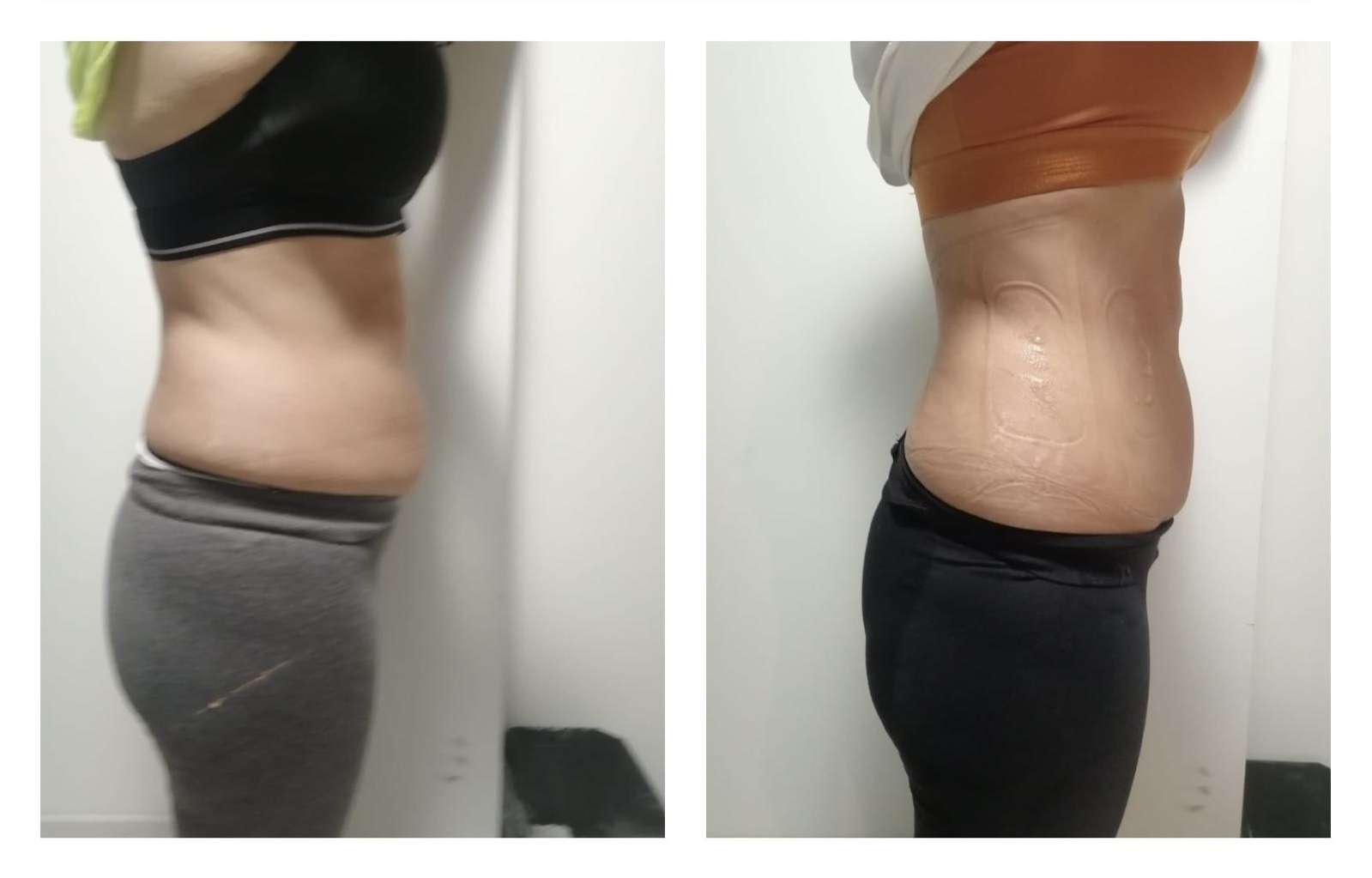 Before After
