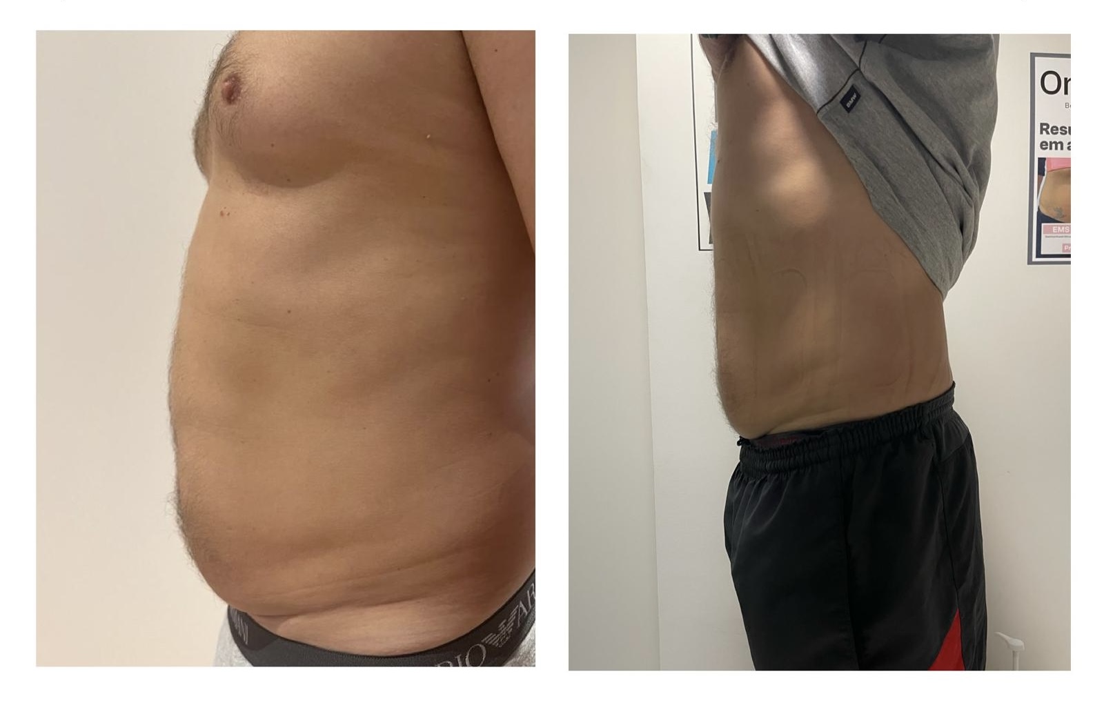 Before After