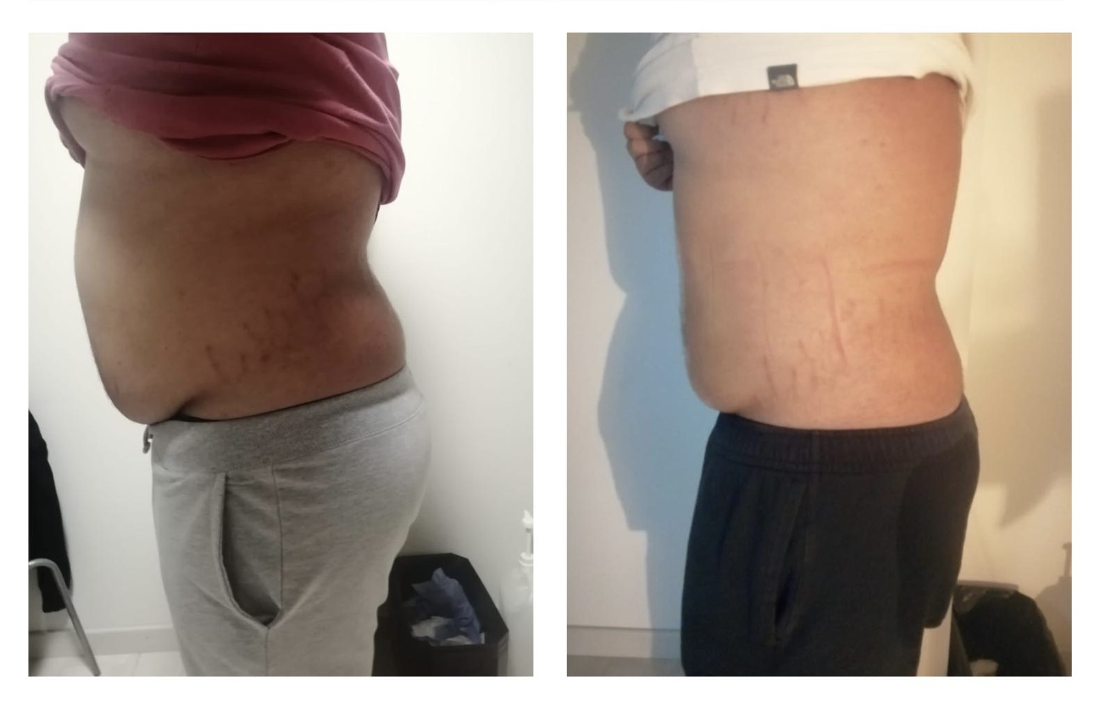 Before After