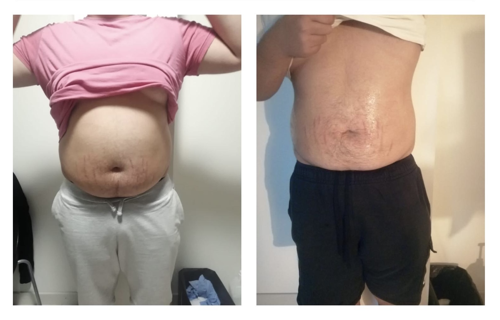 Before After