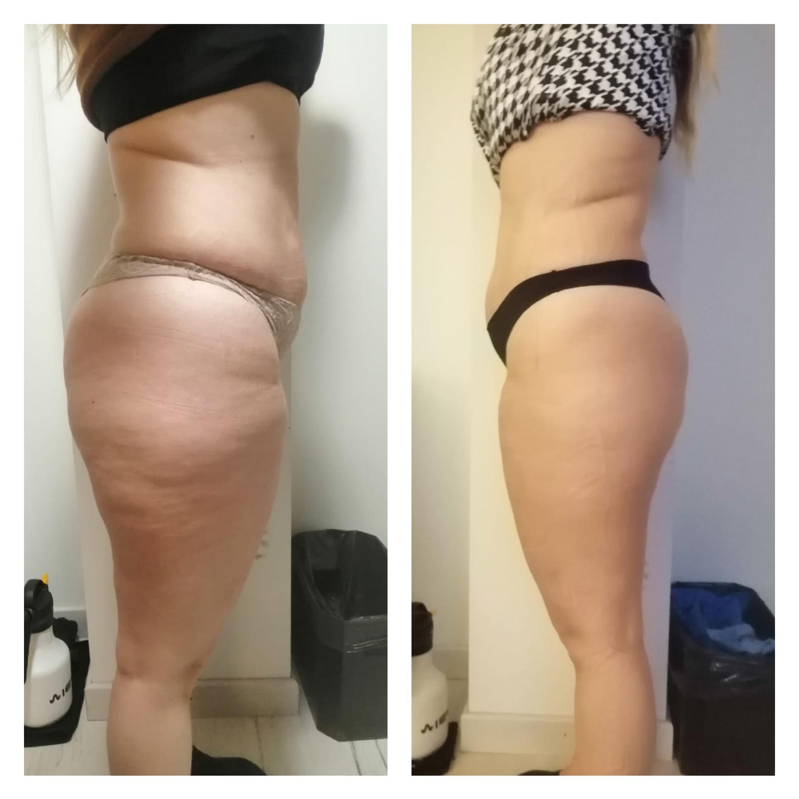 Before After