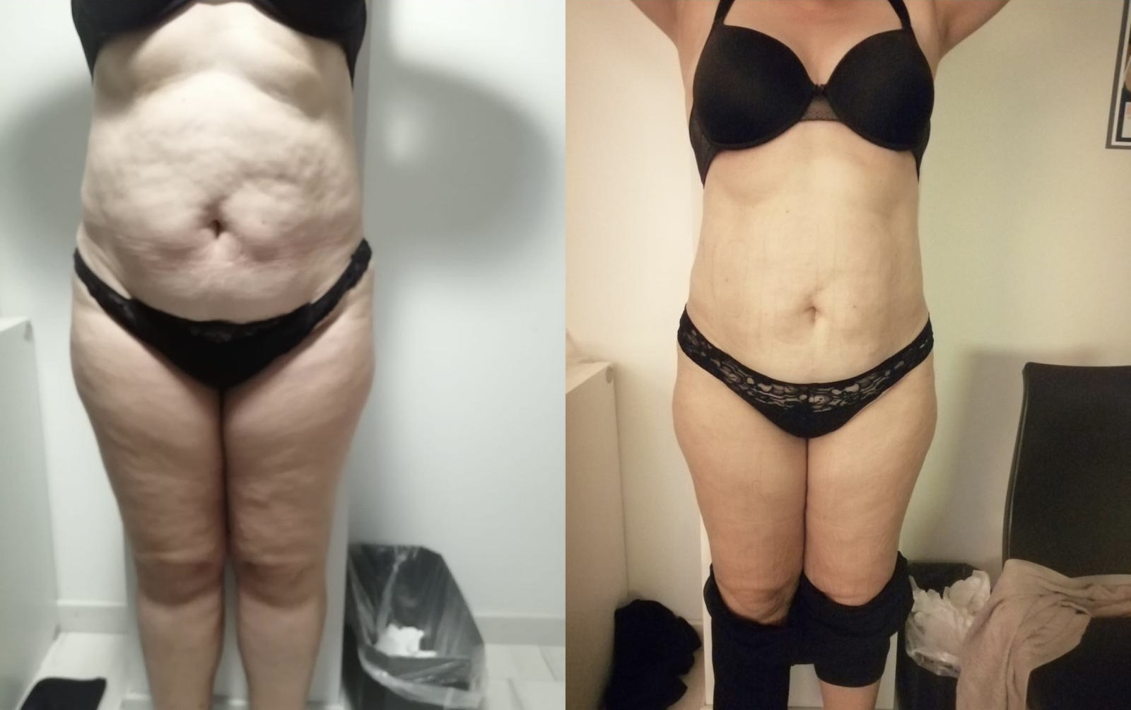 Before After