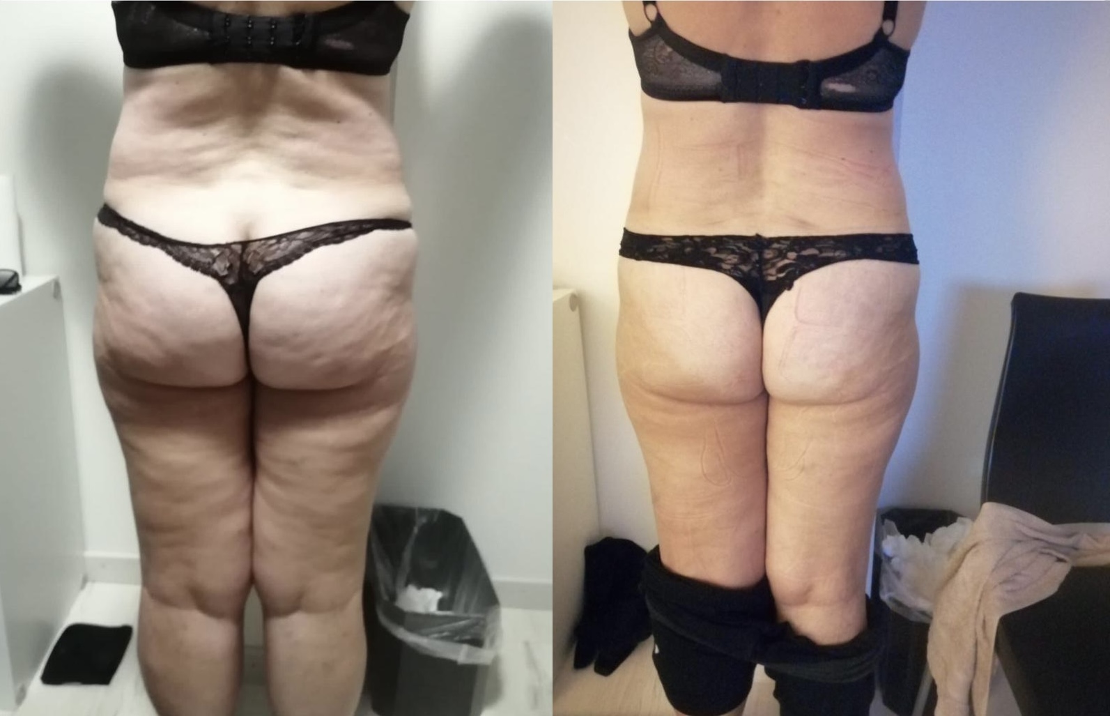 Before After