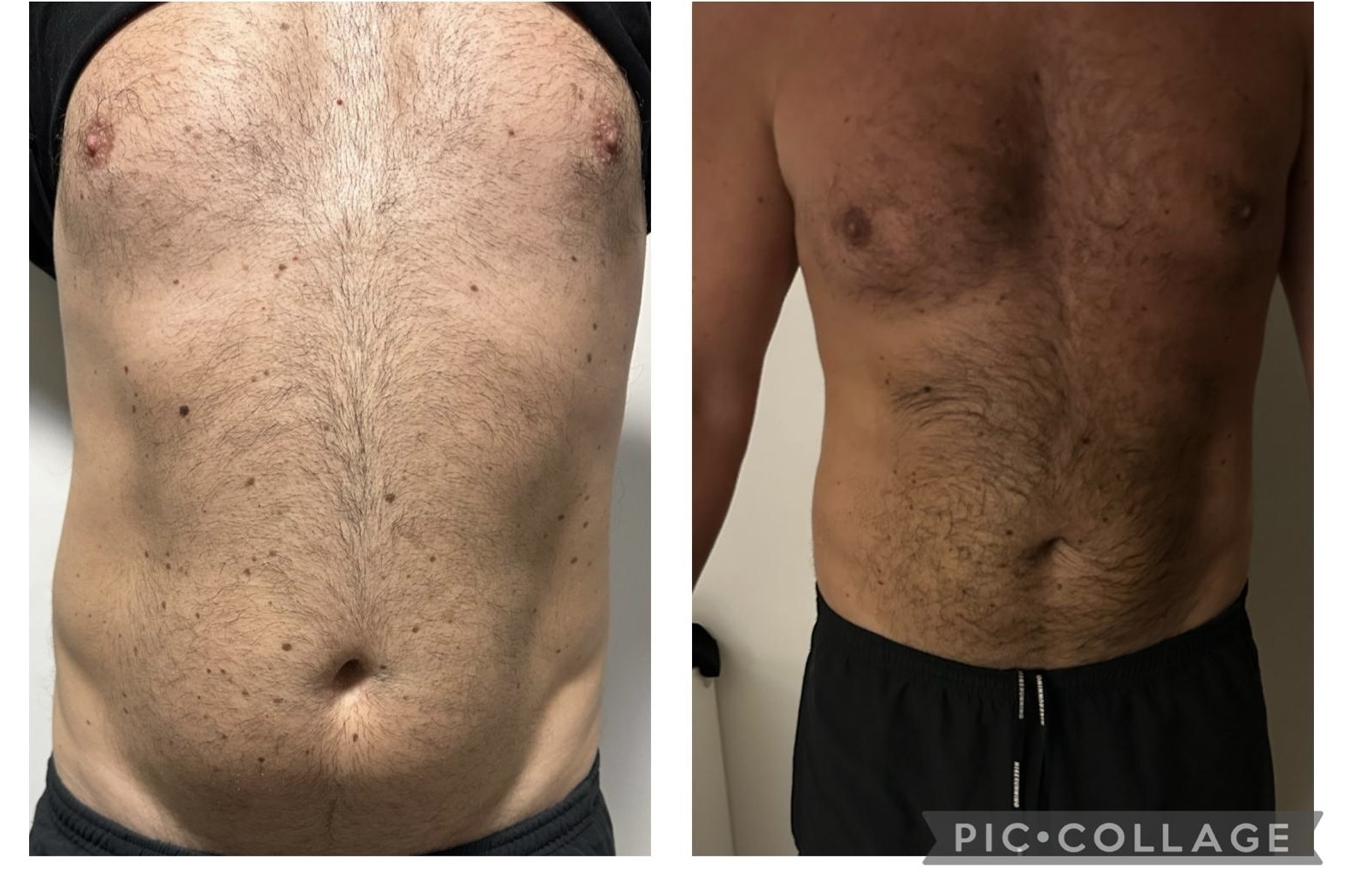 Before After